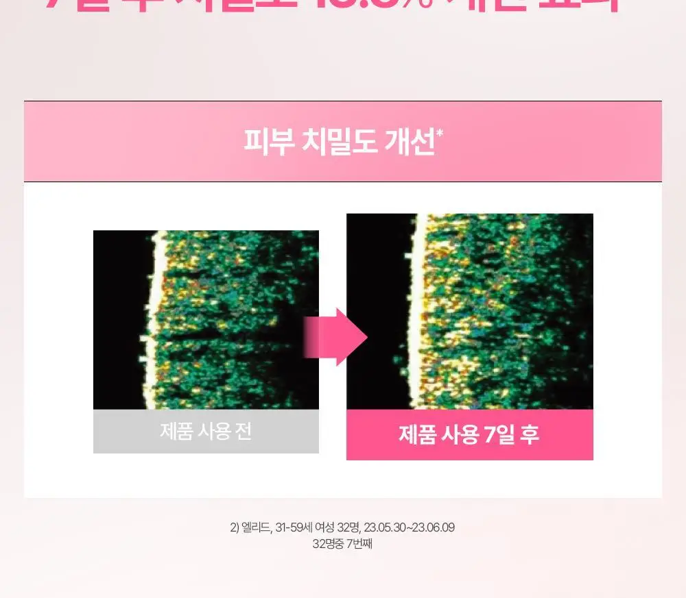 [NEW] 피지오겔 레드 수딩 AI 리페어 크림 100ml 상세페이지 14